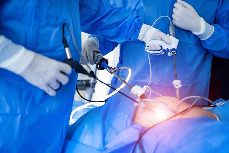 Viszerale Chirurgie: Definition, Indikationen und Risiken